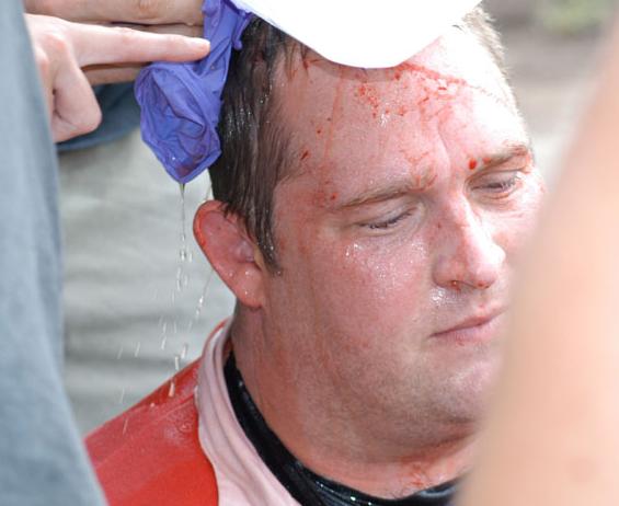 bloody man fighting street brawler cutting bleeding