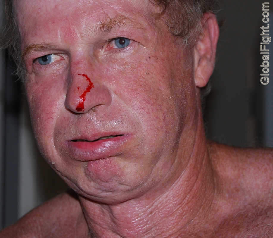 mma older fighting man broken nose bleeding bloody